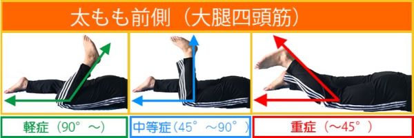 肉離れimg
